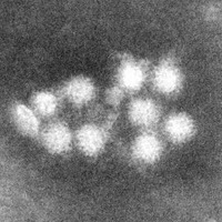 ノロウイルスの電子顕微鏡像　（c）国立感染症研究所