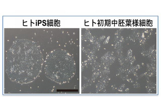 iPS細胞から人の生殖細胞、効率的な誘導に成功…京大研究グループ 画像