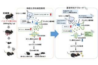 自閉スペクトラム症の新たな病態メカニズムを解明、藤田医科大らの研究 画像