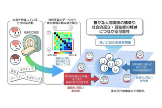 楽観性に共通する脳の働きを可視化…神戸大ら研究成果 画像