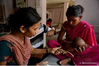 インドの栄養失調児対策、国境なき医師団の活動で一歩前進 画像