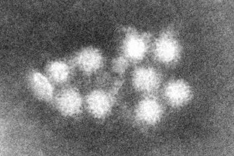 感染性胃腸炎、10都県で警報…受験生は特に注意 画像