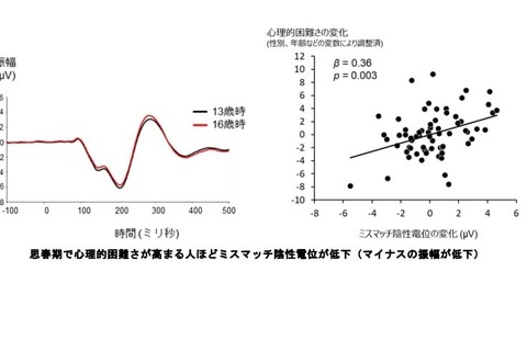 東大附属病院、思春期における心理的困難さと脳の発達の関連を解明 画像