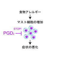 東大、食物アレルギーを抑える分子を発見…治療への応用に期待 画像