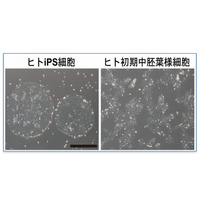 iPS細胞から人の生殖細胞、効率的な誘導に成功…京大研究グループ 画像