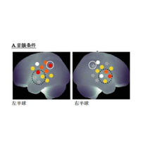 新生児も左右の脳を使い分け…慶大が発表 画像