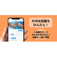 アトピー見える化アプリ「アトピヨ」かゆみ記録機能を追加 画像