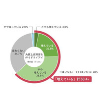 スマホ・カラコンの普及がドライアイ患者の増加に関係 画像