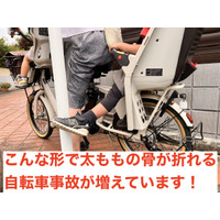 子供乗せ自転車、幼児の太もも骨折が多発…日本小児救急医学会 画像