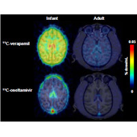 子どもの脳はタミフルの影響を受けやすい…理研ら確認 画像