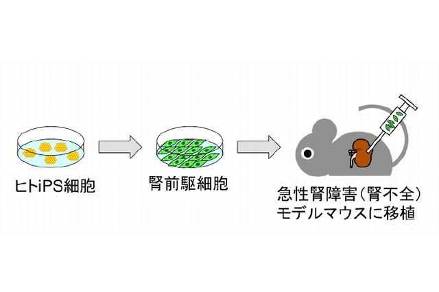 iPS細胞で急性腎障害軽減…京大・アステラス製薬 画像