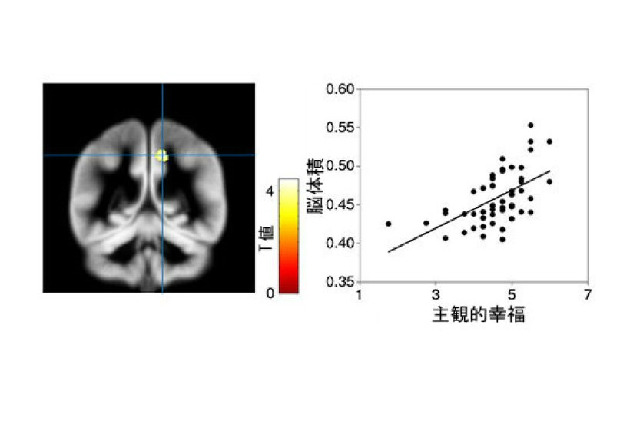 「幸福とは何か？」幸福感と脳の関係、京大研究グループが解明 画像