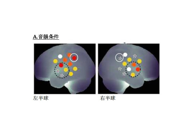 新生児も左右の脳を使い分け…慶大が発表 画像