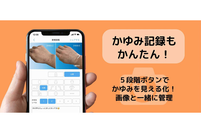 アトピー見える化アプリ「アトピヨ」かゆみ記録機能を追加 画像