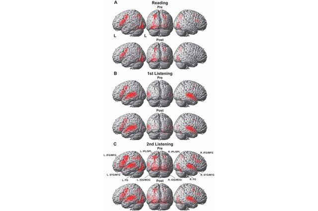 短期間の留学、脳機能に顕著な変化…東大調査 画像