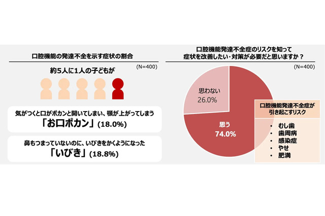 子供の5人に1人「口ぽかん・いびき」口育にはフーセンガム 画像