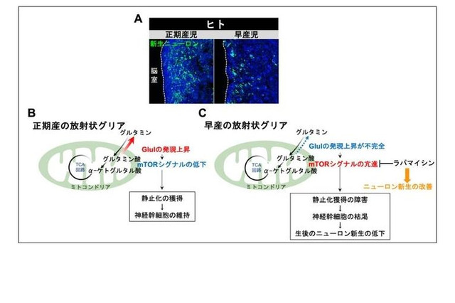 早産児の神経発達予後改善に新知見、名古屋市立大ら研究 画像