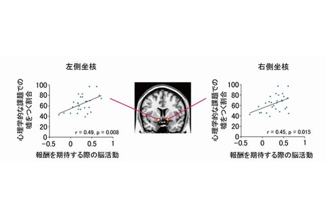 正直者と嘘つきの脳の違いを解明…京大研究グループ 画像