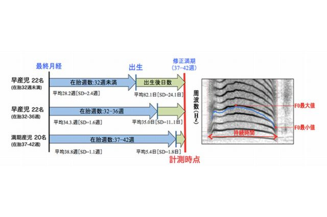 京大、早産児ほど高い声で泣くことを発見 画像