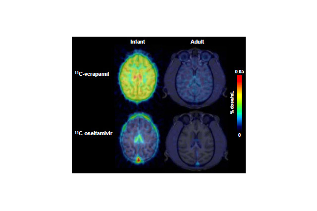 子どもの脳はタミフルの影響を受けやすい…理研ら確認 画像