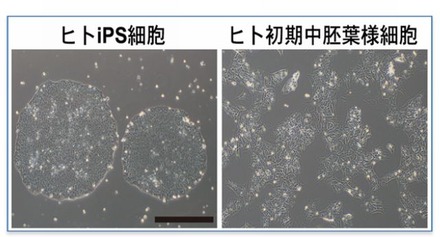 人のiPS 細胞と初期中胚葉様細胞の位相差顕微鏡写真