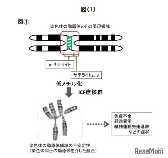 ICF症候群について