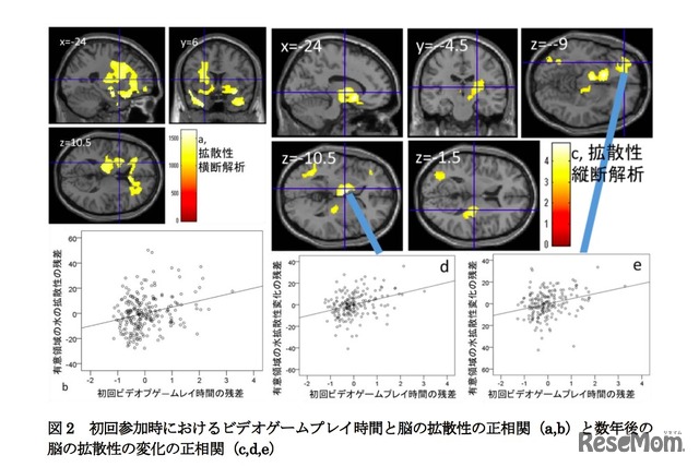 初回参加時におけるビデオゲームプレイ時間と脳の拡散性の正相関（a,b）と数年後の脳の拡散性の変化の正相関（c,d,e）