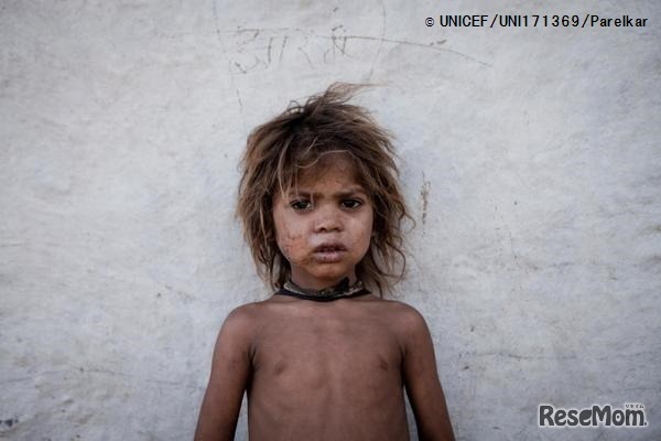 ビルケラ・ダーン村に住む、サハリア族のループシンちゃん(4歳)。(インド・ラージャスターン州 2014年5月30日撮影)(c) UNICEF_UNI171369_Parelkar