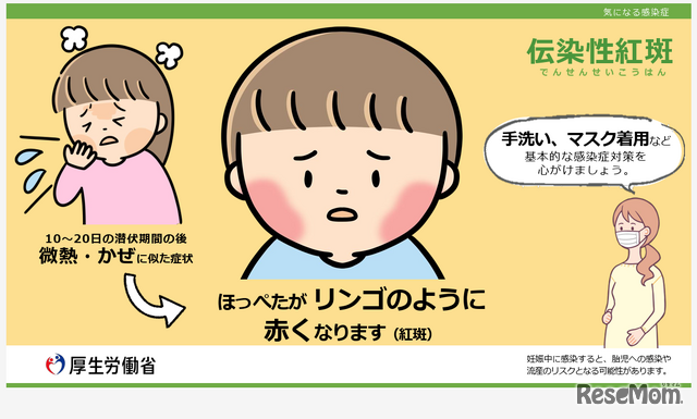 厚生労働省、伝染性紅斑（リンゴ病）に注意喚起