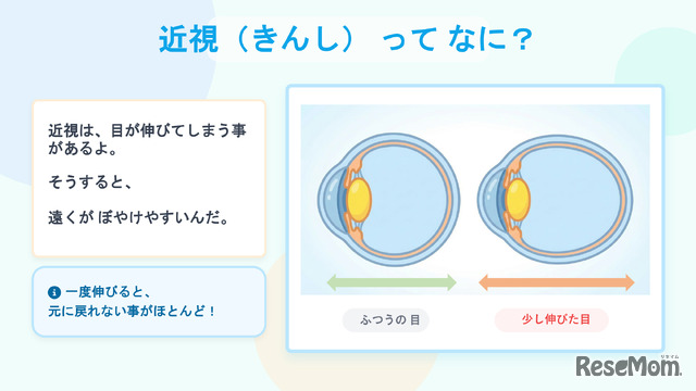 当日のスライド資料「近視ってなに？」