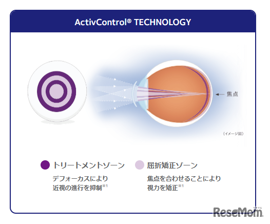 MiSight 1 dayの機序