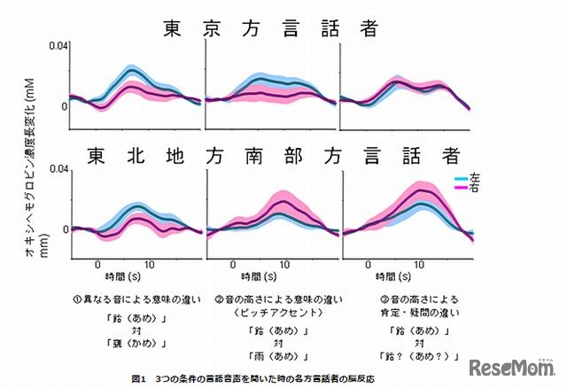 3つの条件の言語音声を聞いたときの各方言話者の脳反応