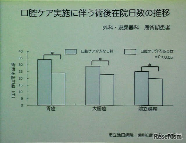 肺炎以外の手術でも口腔ケアが重要