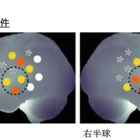 抑揚条件