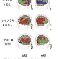 ナイフ使用中、および使用前後でのマス計算中の脳活動量比較（上段：マス計算中の脳活動量／ナイフ使用前、中段：ナイフ使用中の脳活動量、下段：マス計算中の脳活動量／ナイフ使用後）