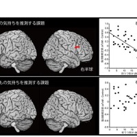 子育てストレスを早期発見、福井大研究グループが評価法開発 画像