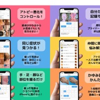 アトピー見える化アプリ「アトピヨ」