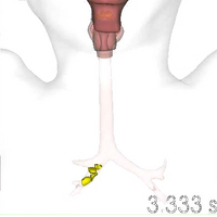 豆の破片が気管内に侵入するシミュレーション