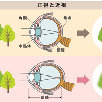 正視と近視