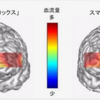 ボードゲーム「ブロックス」で遊んでいる時とスマホの対戦型ゲームで遊んでいる時の脳血流量画像（被験者4名平均）■監修・実施 　古賀 良彦（杏林大学名誉教授・医学博士）