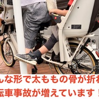 子供乗せ自転車、幼児の太もも骨折が多発…日本小児救急医学会
