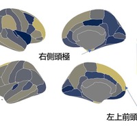 スクリーンタイムは右側頭極、左上前頭回、左吻側中前頭回などの脳領域で皮質厚の減少とも関連