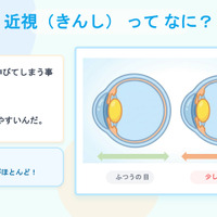 当日のスライド資料「近視ってなに？」