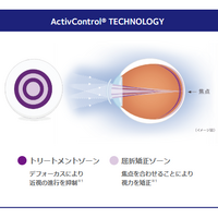 MiSight 1 dayの機序