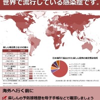 はしか集団発生、新宿区の小学校で児童・教職員18人感染