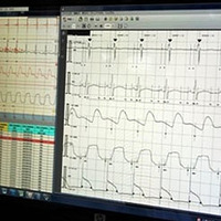心臓電気生理学解析システム