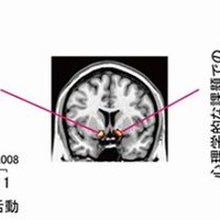 正直者と嘘つきの脳の違いを解明…京大研究グループ