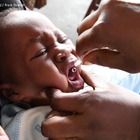 世界的はしか流行の要因はワクチン未接種…年平均2,110万人相当 画像