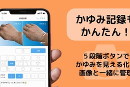 アトピー見える化アプリ「アトピヨ」かゆみ記録機能を追加 画像
